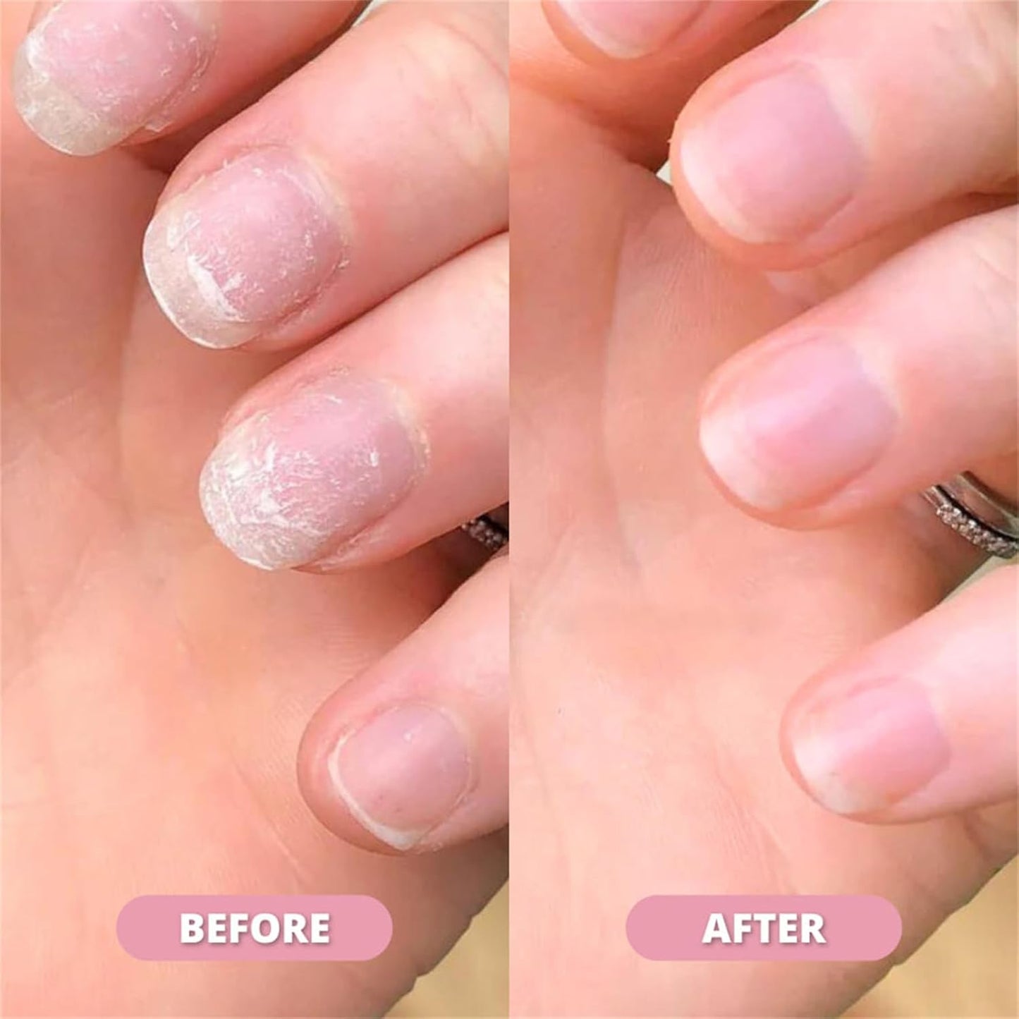 Nail Growth & Cuticle Oil Pen – Strengthening & Brightening Nails