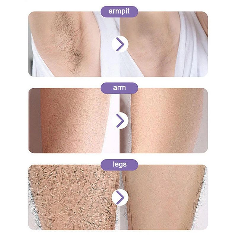Crystal Hair Remover - Portable Epilator for Men and Women Full Body